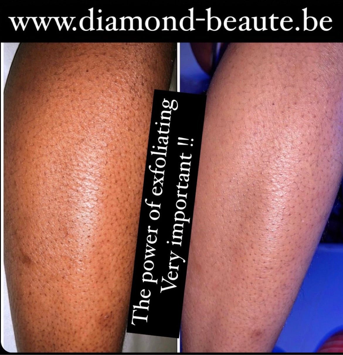 [Gamme] Doux exfoliante serum + creme - Diamond Beaute