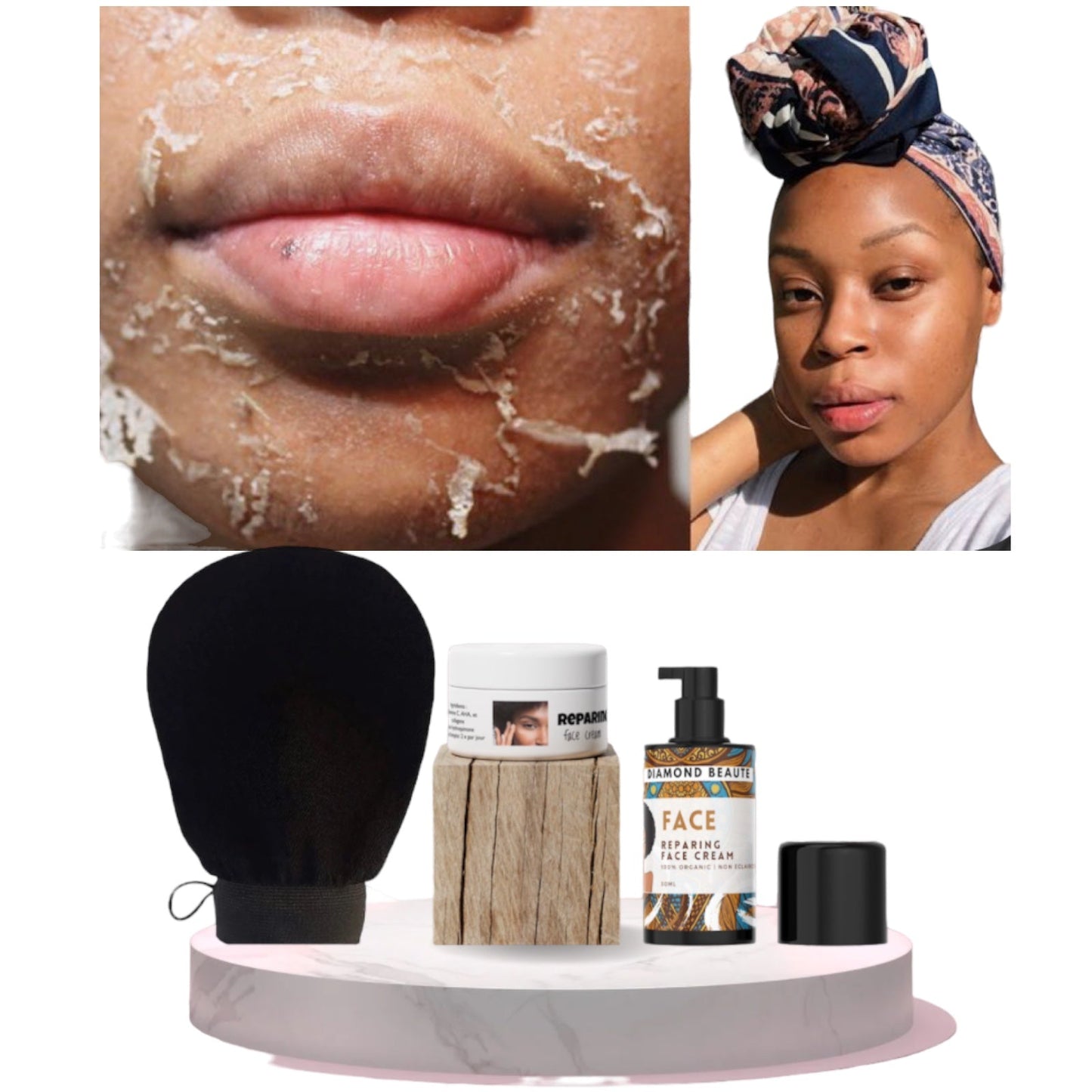 [NOUVEAU] Kit de réparation de solutions 