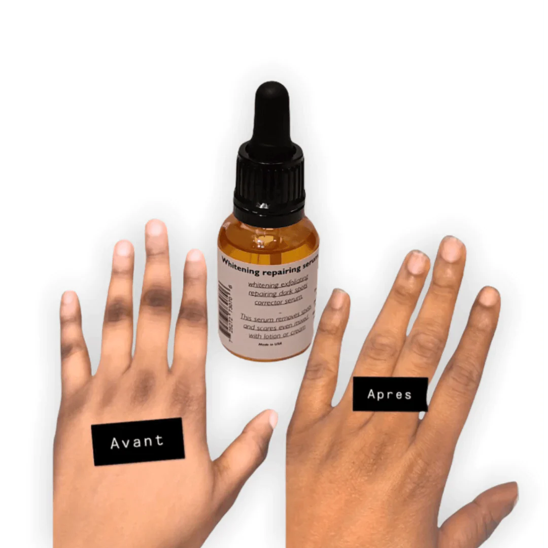 Serum “Reparateur“ Anti Taches “ Mains/Pieds - Diamond Beaute